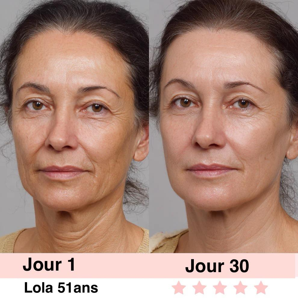 LIFTEXY-Masseur visage anti-rides