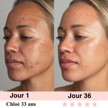 LIFTEXY-Masseur visage anti-rides