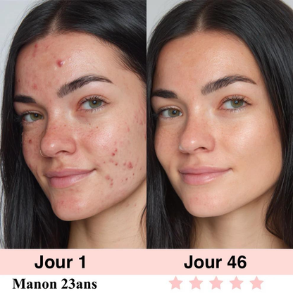 LIFTEXY-Masseur visage anti-rides