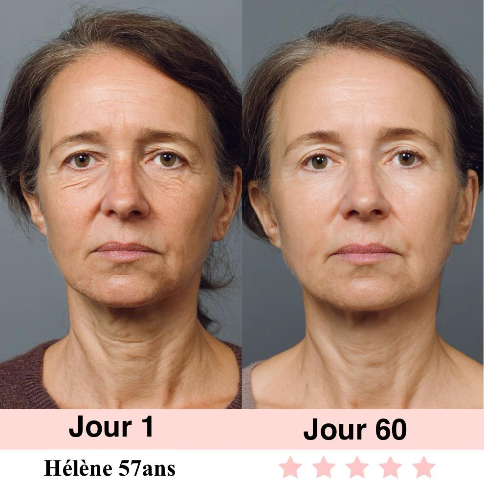 LIFTEXY-Masseur visage anti-rides